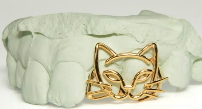 Gold Dental Work